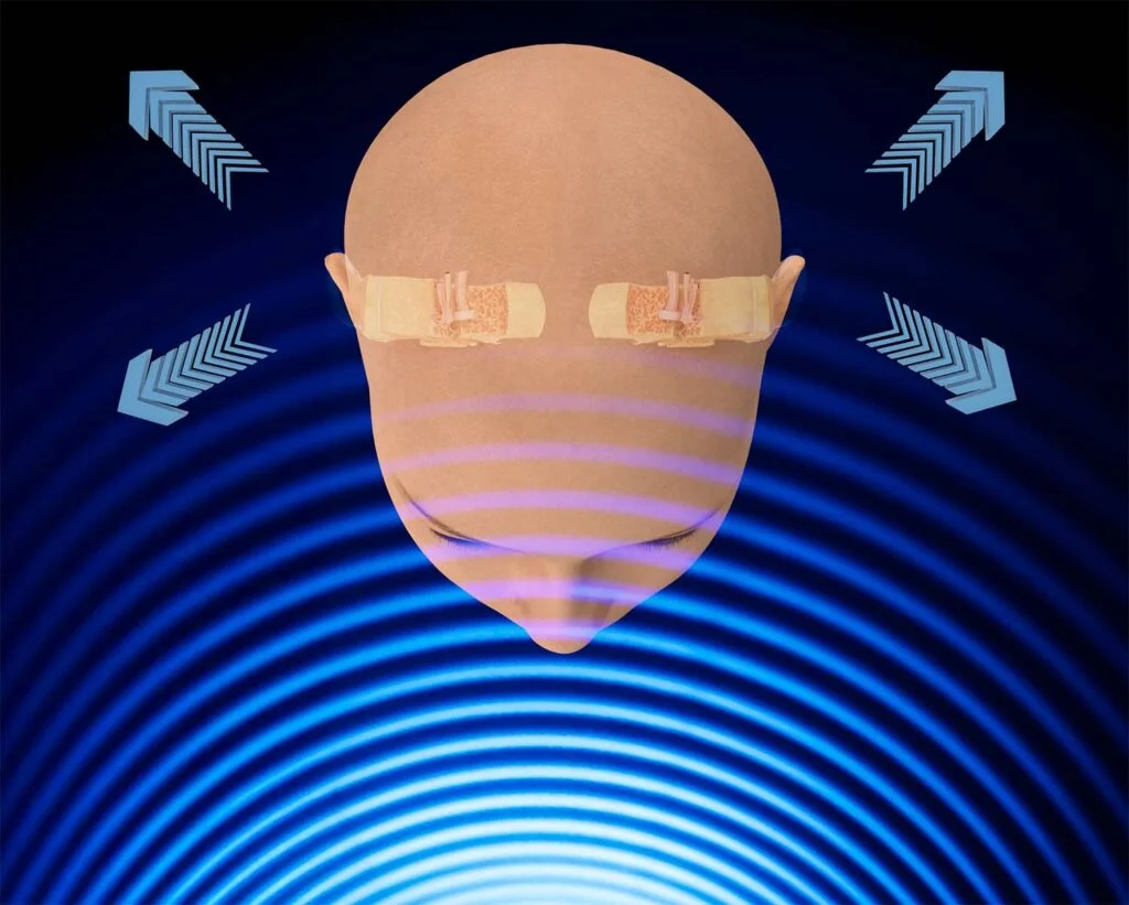 Binaural Hearing